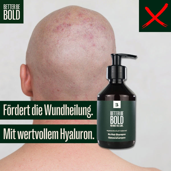 Glatzenshampoo | No Hair Shampoo