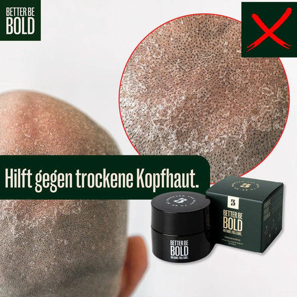 NO HAIR. FULL CARE. BALD CREAM.