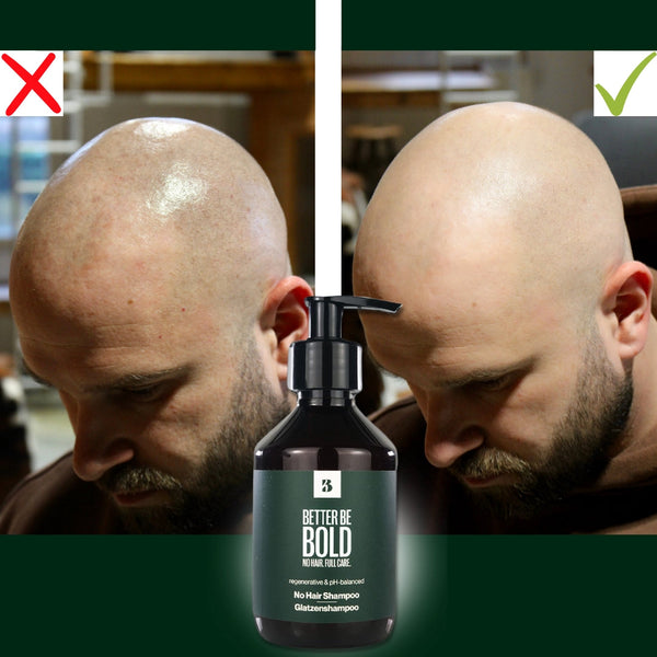 Glatzenshampoo | No Hair Shampoo